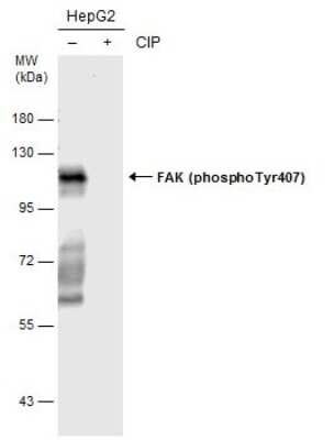 Western Blot: FAK [p Tyr407] Antibody [NBP3-13085]